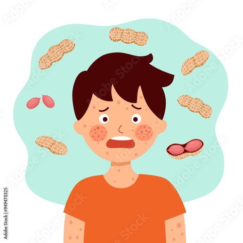 Sad boy child with peanut allergy symptom in flat design.