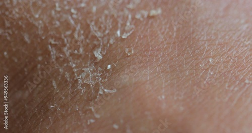 Macro of female dry skin