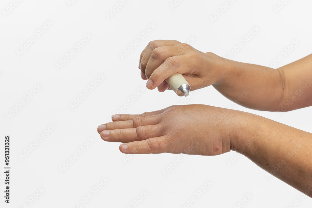 Woman apply a cream on swollen hand from allergic of insect stings. Skin allergic care. Woman apply a cream on swollen hand from allergic of insect stings. Skin allergic care.