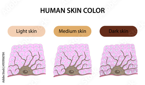 Human skin color: light, medium and dark photo