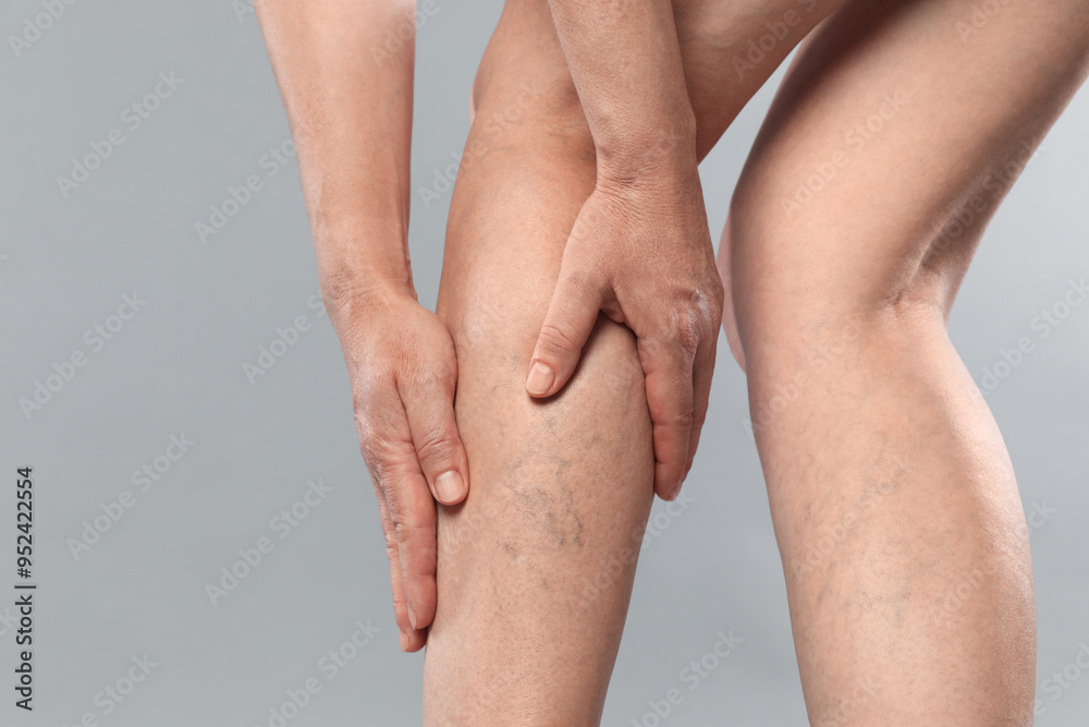 Woman suffering from varicose veins on grey background, closeup. Space for text