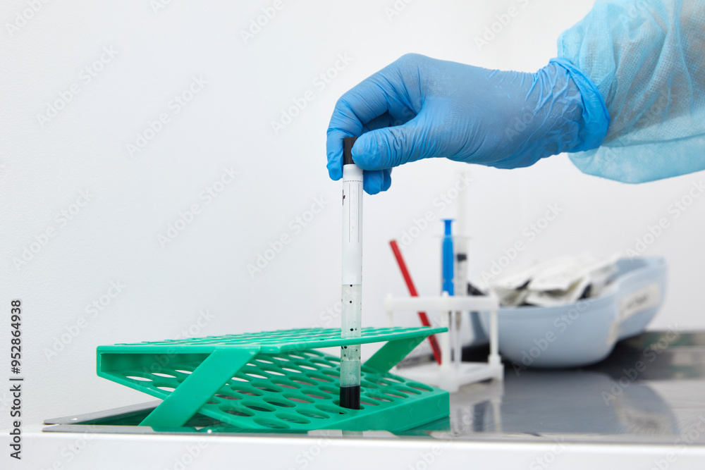 Scientist working with blood sample in laboratory Scientist working with blood sample in laboratory