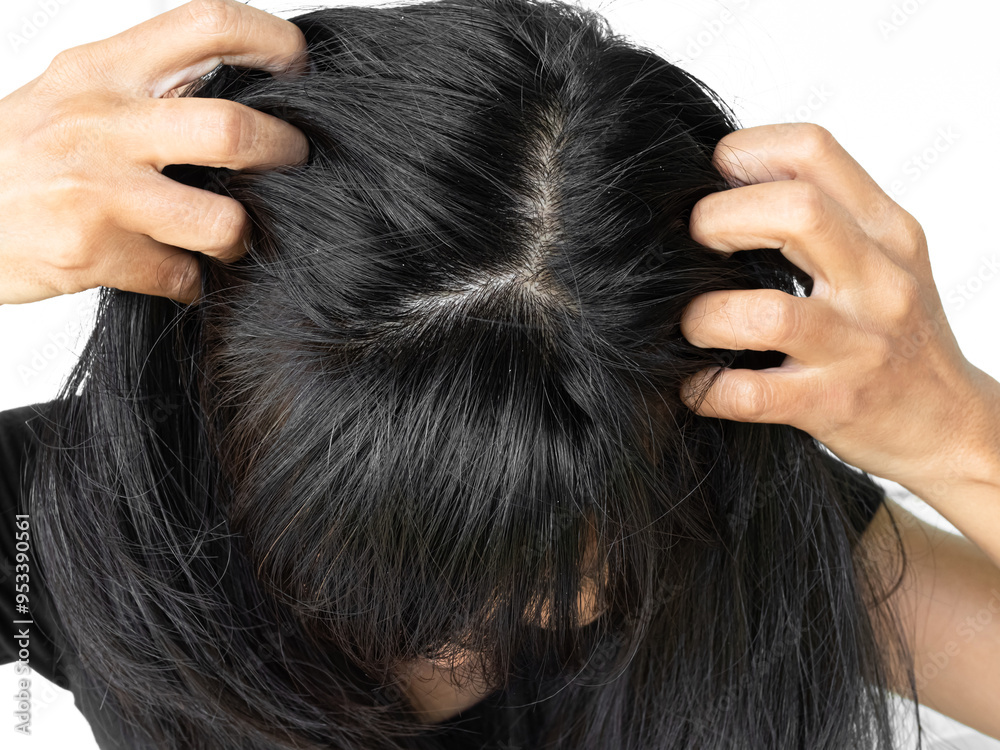 Fototapeta premium Dandruff Itchy scalp, woman chtatch hair messy she dirty, sensitive disease bacteria dander loss, concept for medicine hyginene champoo treatment skin for good health.