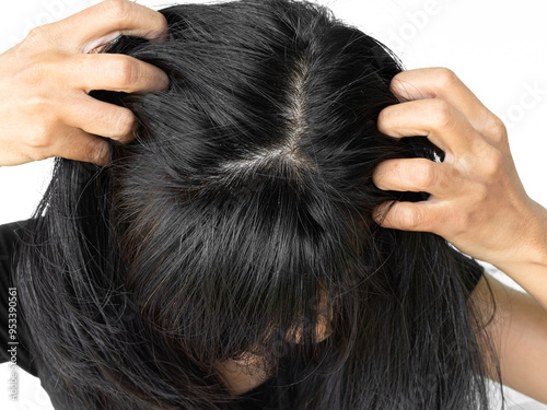 Dandruff Itchy scalp, woman chtatch hair messy she dirty, sensitive disease bacteria dander loss, concept for medicine hyginene champoo treatment skin for good health. photo