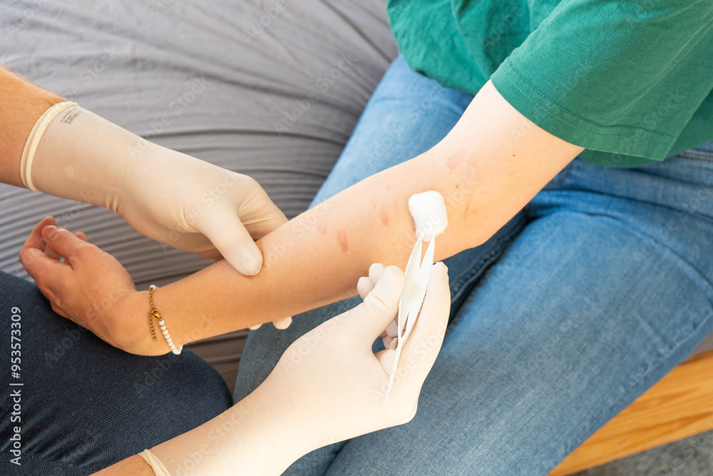 Obraz premium Doctor in Plain Clothes treating arm of a woman. Home care for a girl. Doctor without white coat with white gloves giving home care medical attention to a girl sitting on a bed.