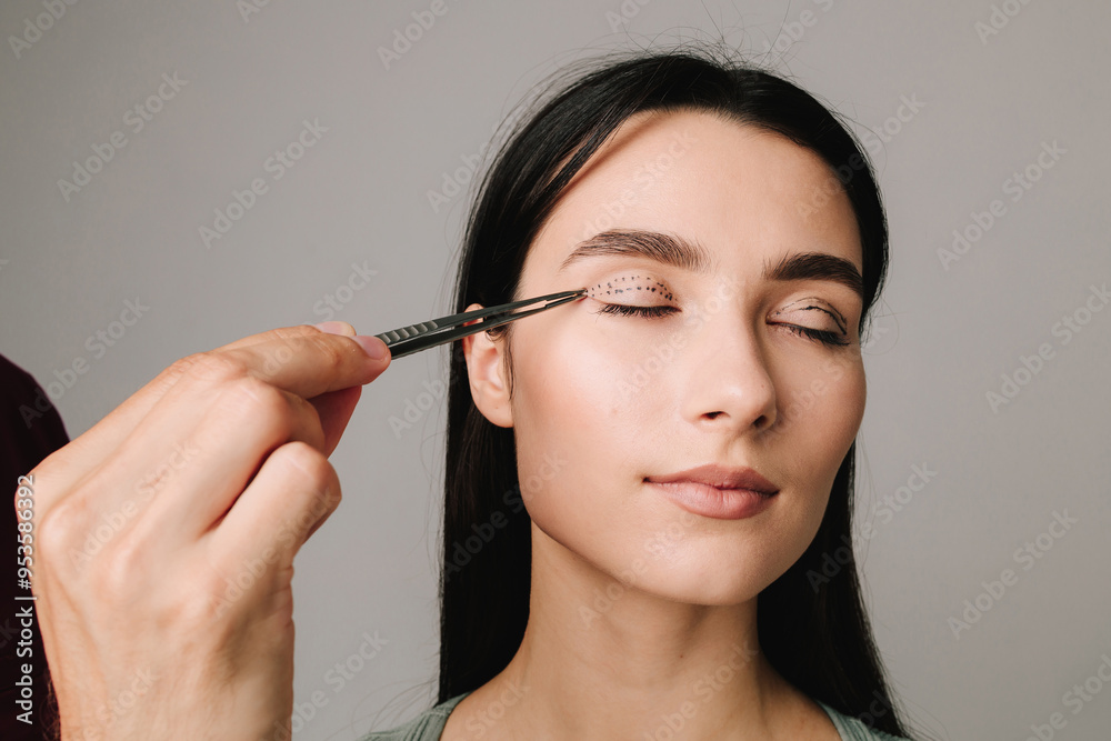 Upper blepharoplasty marking eyelid. Surgeon is checking distance in between dotted lines on eyelid with anatomical tweezers. Upper blepharoplasty marking eyelid. Surgeon is checking distance in between dotted lines on eyelid with anatomical tweezers.