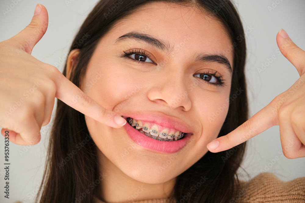 Latin female teenager smiling and pointing at her dental braces.
