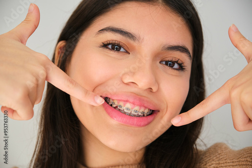 Obraz na płótnie Latin female teenager smiling and pointing at her dental braces. w salonie