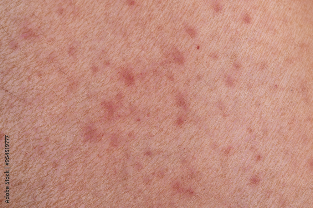 Fototapeta premium Human skin showing symptoms of chronic skin disease