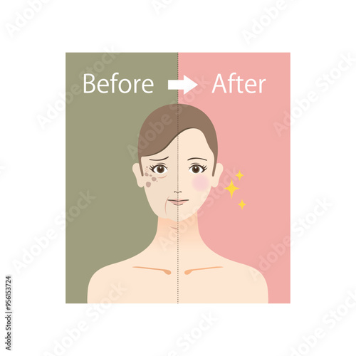 美容のイラスト　老け顔に悩む女性のビフォーアフター