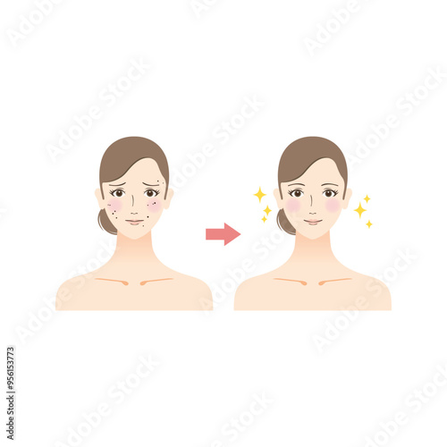美容のイラスト　ほくろに悩む女性のビフォーアフター