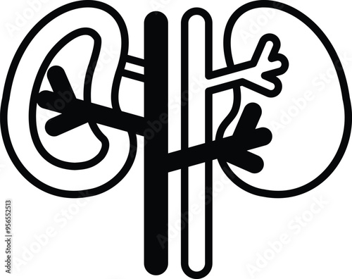 A drawing of a pair of kidneys with black and white lines