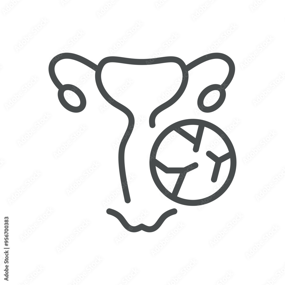 Vaginal Atrophy and Dryness Icon. Thin Line Illustration of Female Reproductive System with Cracked Symbol, Representing Menopausal Changes and Health Issues. Isolated Outline Vector Sign. Vaginal Atrophy and Dryness Icon. Thin Line Illustration of Female Reproductive System with Cracked Symbol, Representing Menopausal Changes and Health Issues. Isolated Outline Vector Sign.