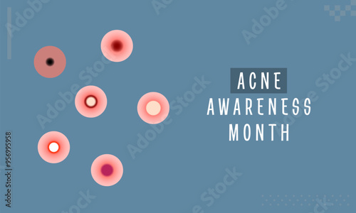 Acne Awareness Month. Acne and Skin Problem. Body skin acne type blackheads, whiteheads, papule, pustule, cyst and nodules. Acne types, skin pimples blackheads and face comedones