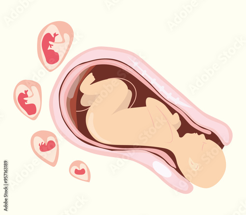 Normal Delivery and Natural Vaginal Child Birth