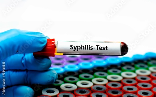 Photography Blood sample tube for syphilis test analysis.