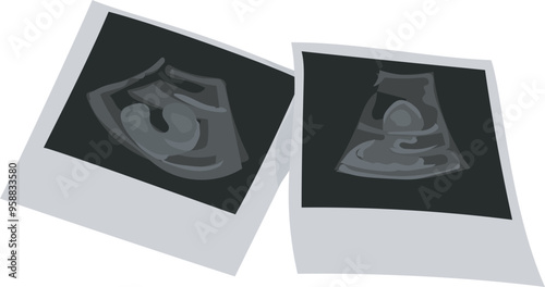 Cartoon ultrasound illustration on transparent background.
