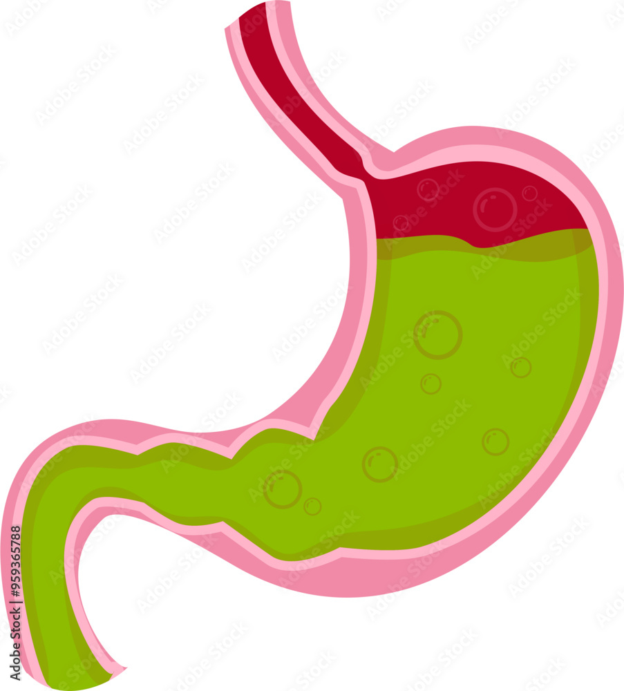 Stomach disease Illustration. Stomach asid reflux Stomach disease Illustration. Stomach asid reflux