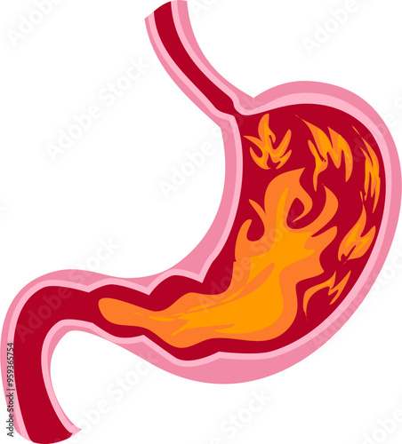 Stomach disease Illustration. heartburn 