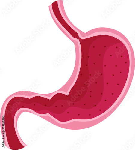 Stomach disease Illustration. Gastric erosion 