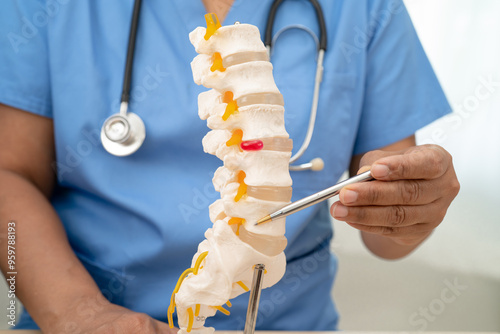 Doctor with lumbar vertebra bone skeleton and nerve model for treatment in the orthopedic department. photo