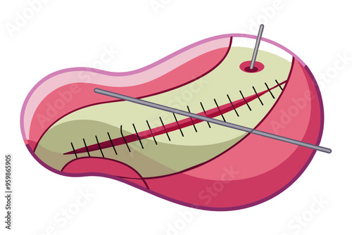  Medical equipment surgical suture vector art illustration 