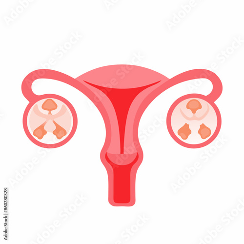 Anatomy of the female reproductive system Diagram of the location of the organs uterus cervix ovary (7)