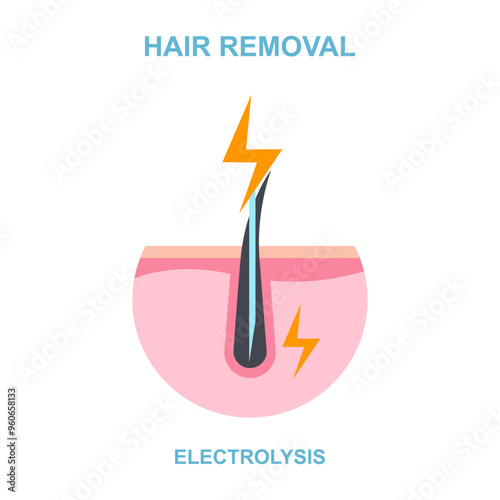 Procedure hair removal electrolysis, vector illustration for cosmetology salon salon.