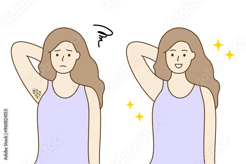 Set of young woman with dark smelly hairy and smooth clean armpit. Beauty routine, laser innovation, hair removal, body care concepts. Hand drawn people  character vector before after illustrations.