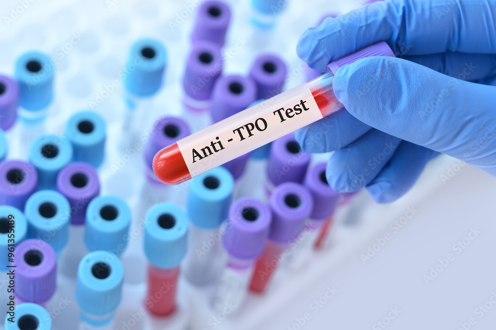 Obraz premium Doctor holding a test blood sample tube with Anti TPO (anti-thyroid peroxidase) test on the background of medical test tubes with analyzes.