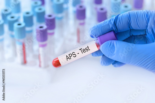 Doctor holding a test blood sample tube with antiphospholipid syndrome (APS) test on the background of medical test tubes with analyzes. photo