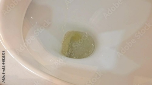 A faint stream of urine trickles down the toilet. Concept of urinary diseases, difficulty urinating, prostate problems.