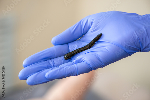 Hirudotherapy procedure. Doctor applying leech to patient's body. Close-up of doctors hand with leech. Hirudotherapy, Ethnoscience and Alternative medicine. Selective focus. photo