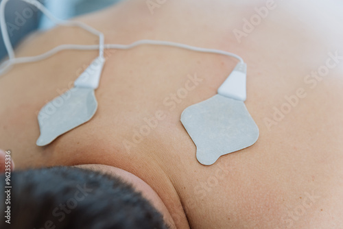 Electrotherapy session with electrodes for back pain relief in a physiotherapy clinic setting photo