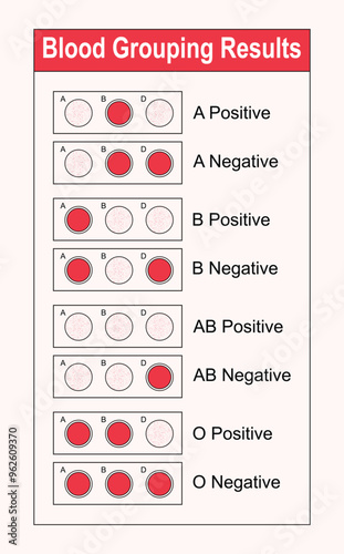 anatomy, antibody, cell, chart, donor, droplet, donate, education, group, illustration, health, laboratory, liquid, negative, microbiology, positive, plasma, red, science, test, blood, type, bloods