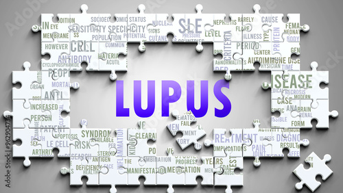 Lupus as a complex subject, related to important topics. Pictured as a puzzle and a word cloud made of most important ideas and phrases related to lupus. ,3d illustration