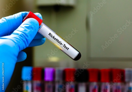 Blood sample tube for rickettsia test analysis. photo