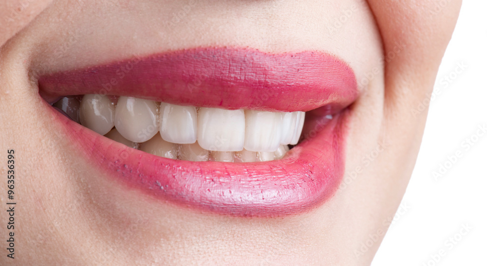 ceramic veneers b1 color ceramic veneers b1 color