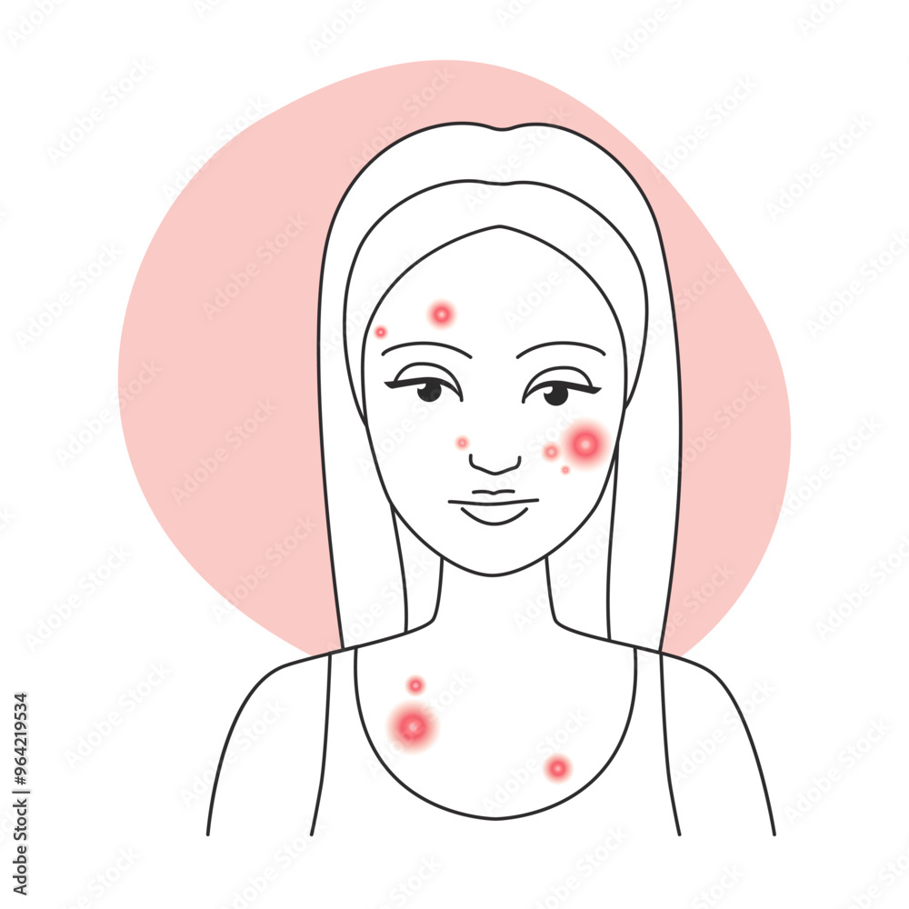 Vector illustration of a female portrait with acne and a light pink background. Vector illustration of a female portrait with acne and a light pink background.