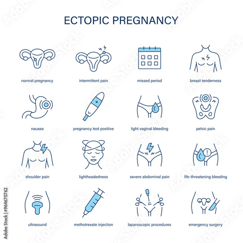 Ectopic Pregnancy symptoms, diagnostic and treatment vector icons. Medical icons.