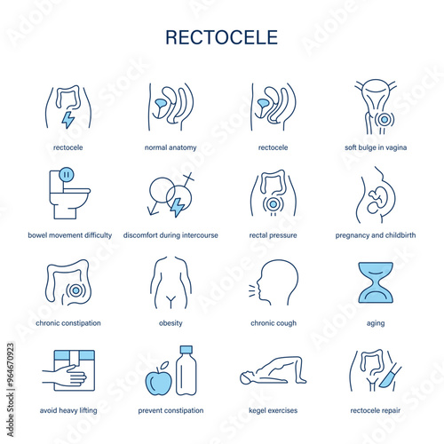 Rectocele symptoms, diagnostic and treatment vector icons. Medical icons.