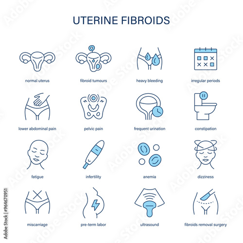 Uterine Fibroids symptoms, diagnostic and treatment vector icons. Medical icons.