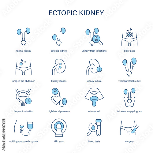 Ectopic Kidney symptoms, diagnostic and treatment vector icons. Medical icons.