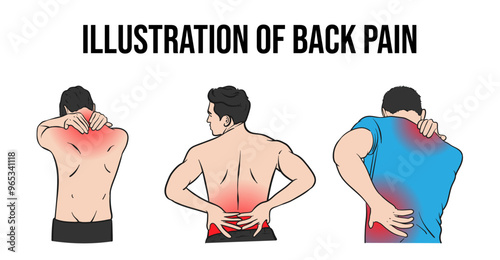 Vector illustration of different locations of back pain disease
