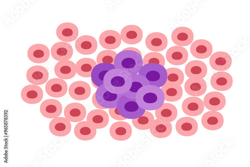 cancer tumor cell disease concept