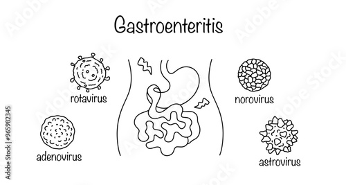 Gastroenteritis photo