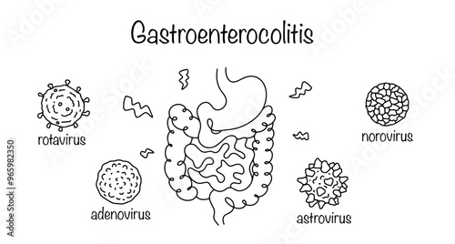 Gastroenterocolitis photo