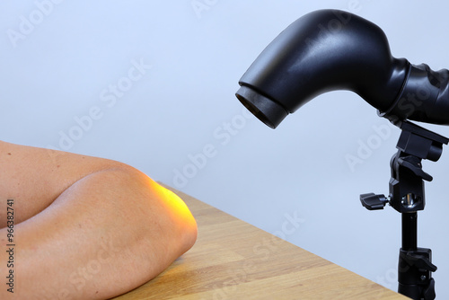 Therapeutic lamp for light rehabilitation, improving the condition of inflamed joints and more.