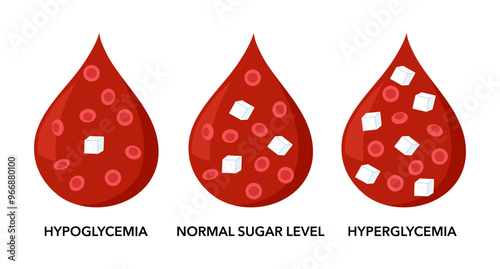 Glucose level in the blood: normal sugar level, hyperglycemia, hypoglycemia vector illustration.