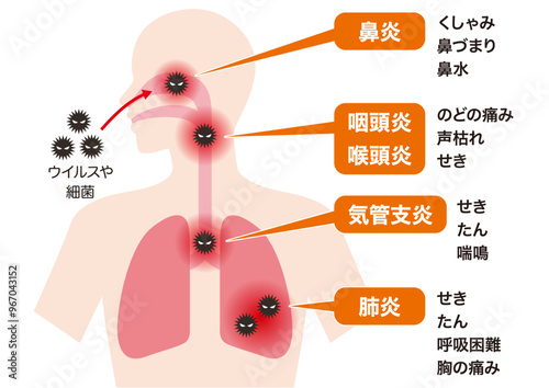 呼吸器感染の場所と病名・症状